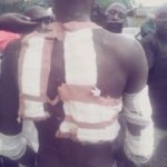 Victim Of Plateau STF Brutality Cries Out; As Community Clamours For Intervention