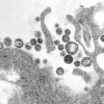 FG Confirms Outbreak of Lassa Fever in Abuja, one dead