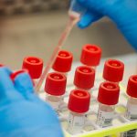 Nigeria Records 1,664 New COVID-19 Cases – Lagos 642