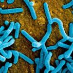 Two Die From Marburg Virus Disease Outbreak In Ghana