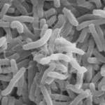 Cholera: FCTA Increases Sensitisation As Death Toll Reaches 60