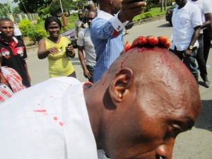 An unidentified victim of today's Rivers State Police Command's assault on lawmakers, journalists, including a 2-year old. Photo Credits: Bekee Anyalewechi